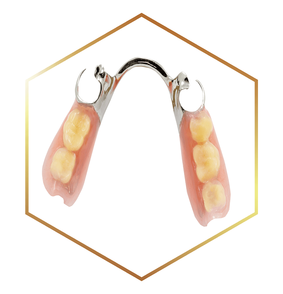 close up of partial denture