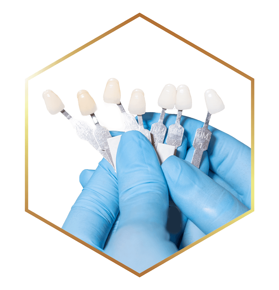 frame of close model of porcelain veneers